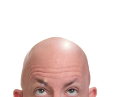 bald_head